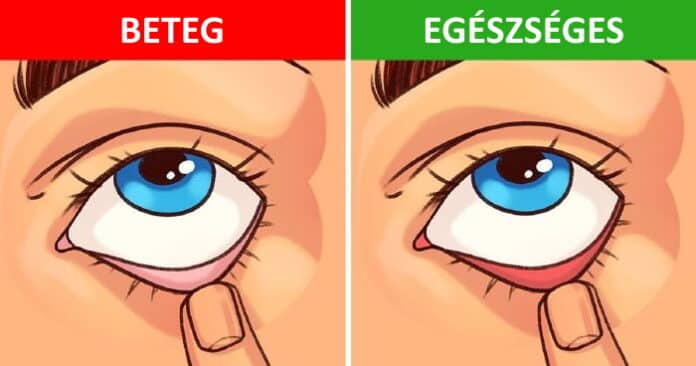 egeszseg ellenorzes, egeszseg, egeszseges eletmod, 8