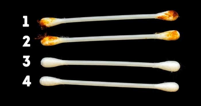 fülzsír fülzsír típusok egészség egészséges életmód életmód tippek