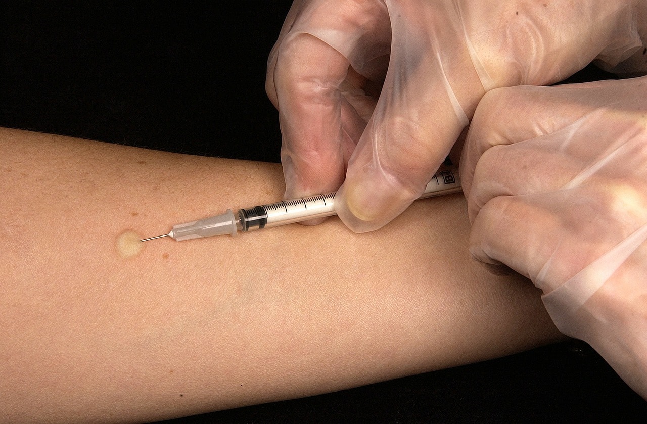 deli klinika immunologia immunrendszer immunologiai betegsegek autoimmun betegesegek
