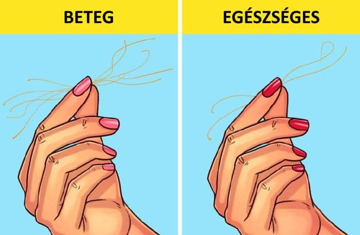 egeszseg ellenorzes, egeszseg, egeszseges eletmod, 4