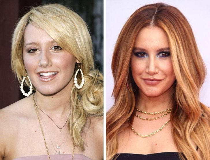 hiressegek plasztikai mutet Ashley Tisdale
