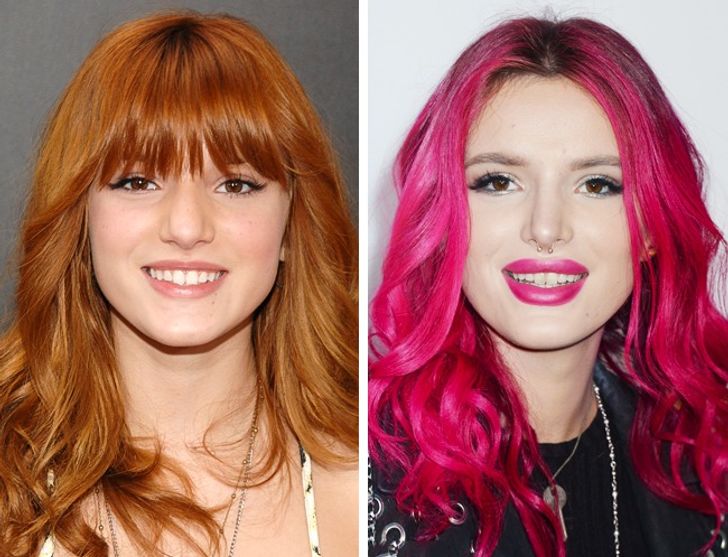 hiressegek plasztikai mutet Bella Thorne