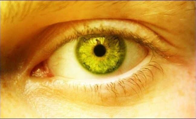 maj problema jelei, maj problema 5