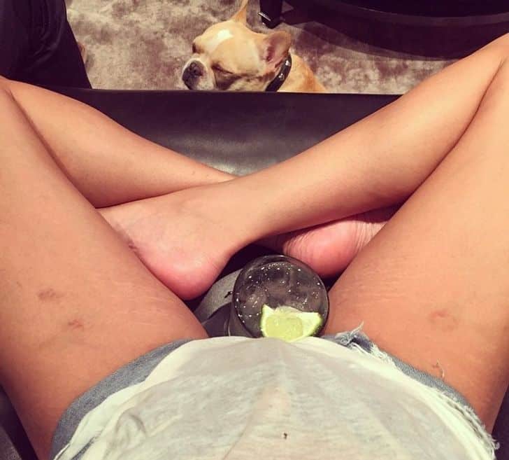 tokeletlen hiressegek body shaming Chrissy Teigen