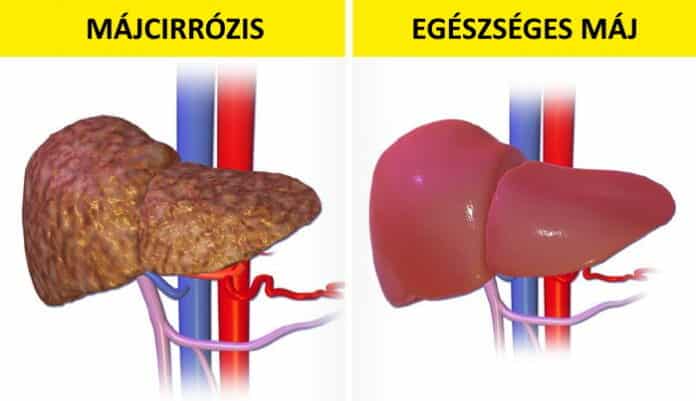 napi 2 csesze kave egeszseges, a kave egeszseges, tovabb elsz a kavetol 9