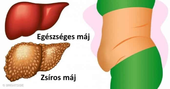 maj problema jelei, maj problema