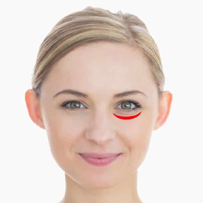 arcbor egeszseg, arcbor rancainak jelentse, arcbor, rancok jelei, miert vannak arcbor rancok15