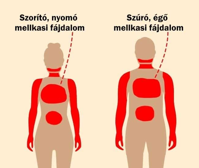 szívroham szívroham jelei test jelzése egészség egészségügyi probléma
