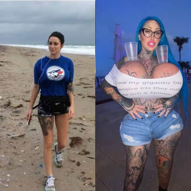 onlyfans-sztar-legkoverebb-vagina-operacio-oriasi-valtozas-2